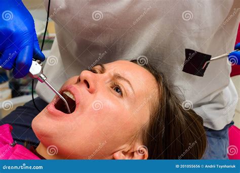 Dentist washes oral cavity, dental treatment - sound effect