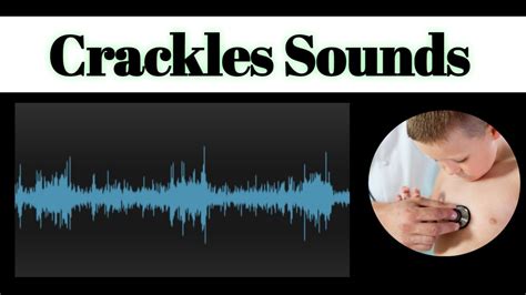 Clicks, crackles, noises - sound effect