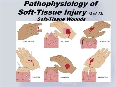 Tissue tear (2) - sound effect