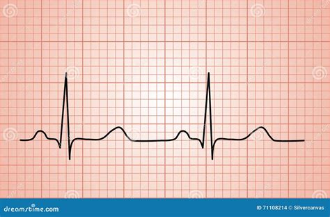 Ecg sound effects