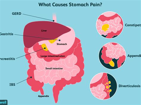 Rumbling in the stomach - sound effect