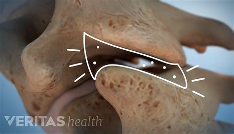 Cracking of bones or cartilage joints - sound effect