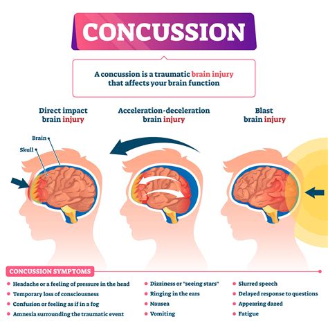 Concussion effect, shock, hearing loss (4) - sound effect