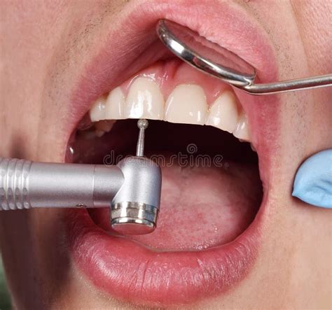 Sounds of a dental drill