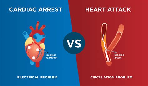 Sound effect for trailer cardiac arrest