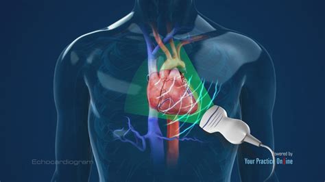 Cardiographer, cardiac arrest - sound effect