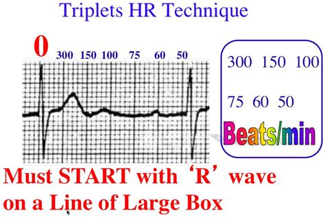 Ripple, pulse, beat (6) - sound effect