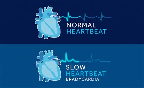 Slow heartbeats - sound effect