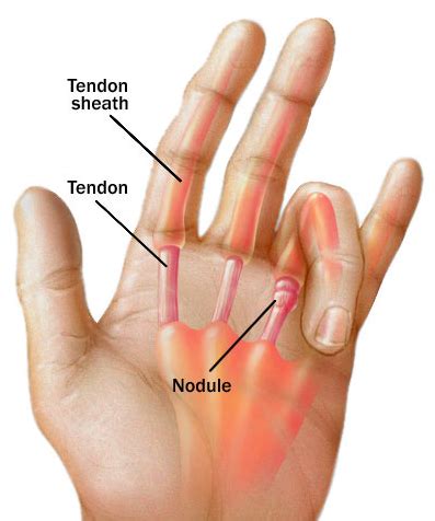 Finger crunching, kneading joints - sound effect