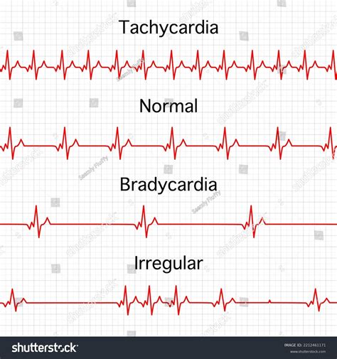 Heartbeat (3) - sound effect