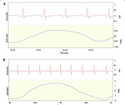 Woman's restless breathing, reverse echo effect (2) - sound effect