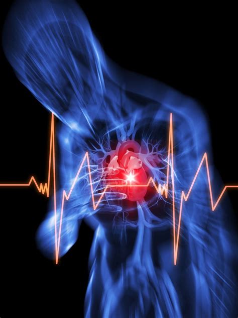 Hospital, cardiometer, heart failure, cardiac arrest - sound effect