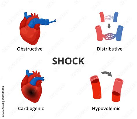 Shock sound effects