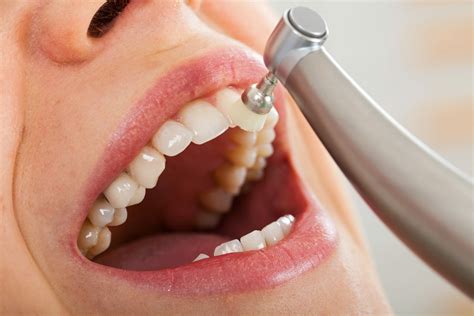 Teeth cleaning (3) - sound effect