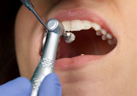 Teeth cleaning (4) - sound effect