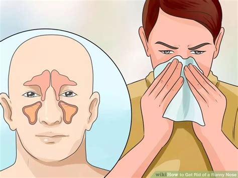 Nasal congestion, runny nose - sound effect